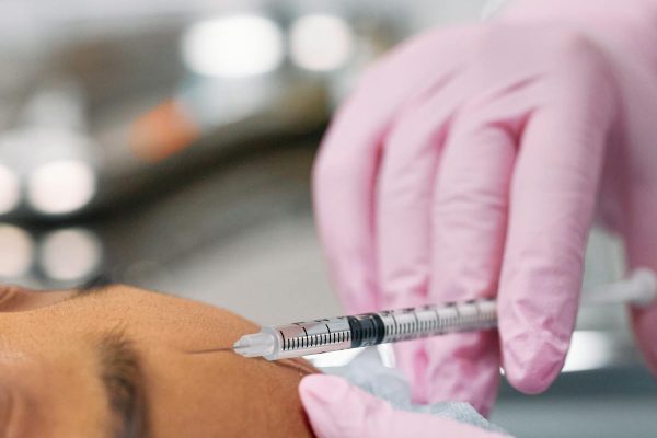 Close-up of dermal filler injection procedure