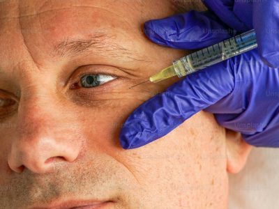 Botox injection being administered near eye area by provider