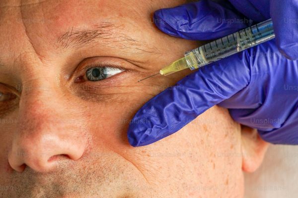 Botox injection being administered near eye area by provider
