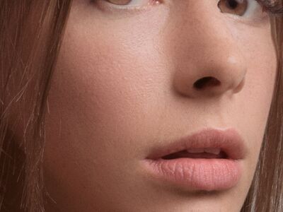 Botox and Dysport injectable neurotoxin comparison