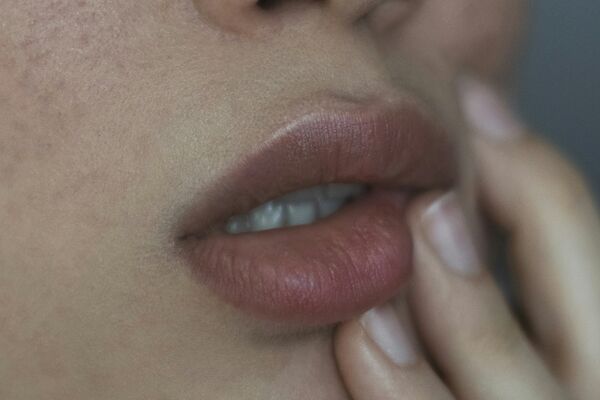 Cheek filler injection for facial contouring and volume