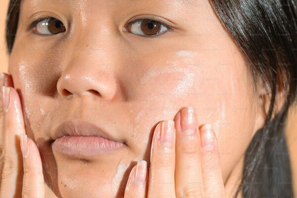 Chemical peel recovery process showing skin healing stages