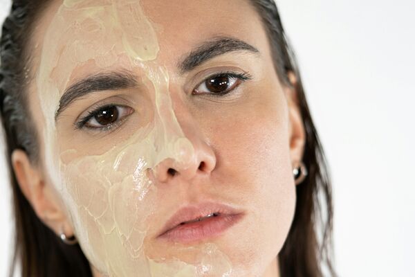 Deep chemical peel intensive resurfacing for transformation