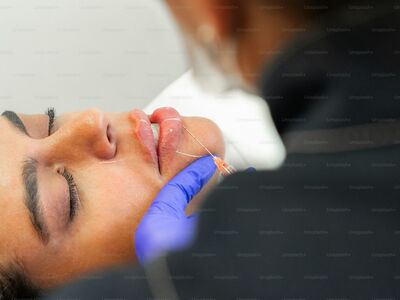 Dermal filler products including Juvederm and Restylane for facial rejuvenation
