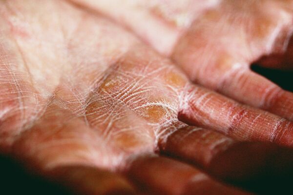 Advanced skincare technology used in medical spa settings