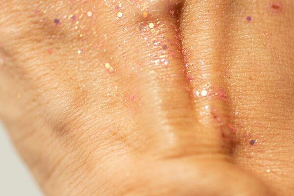 Microneedling treatment stimulating collagen production