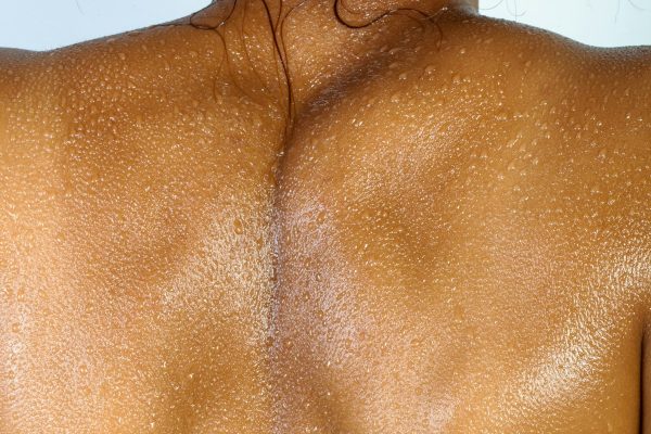 Beautiful glowing dark skin suitable for laser hair removal treatment